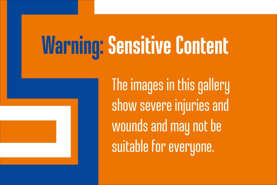 Sensitive-Content-Warning.jpg